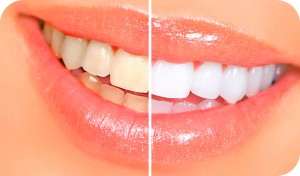 Estética dental