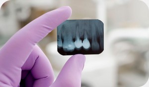 Cirugía maxilofacial