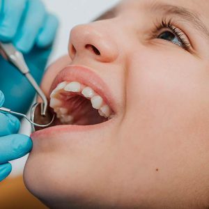 Programa PADI de Odontopediatría